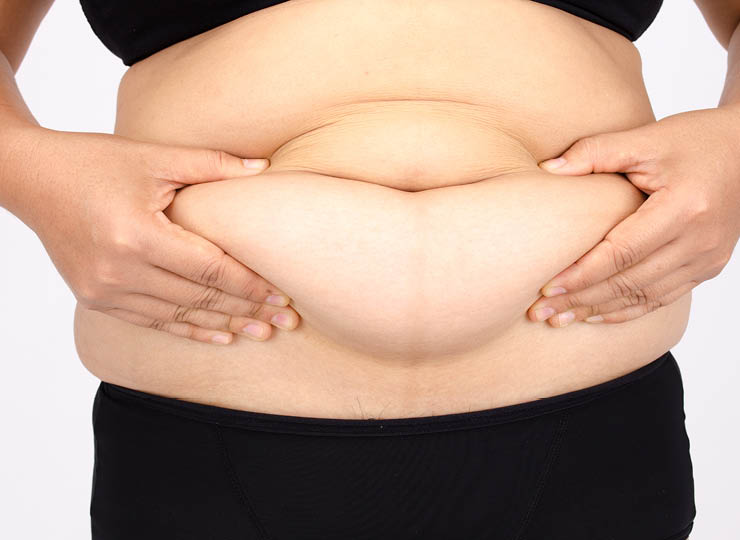 person with a fat belly